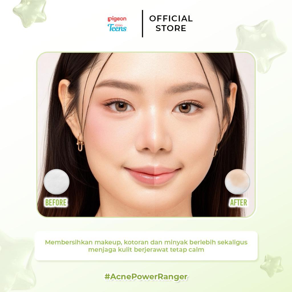 Pigeon Teens Acne Ranger Micellar Water | Micellar Water Remaja untuk Kulit Berjerawat | Membersihkan Makeup & Minyak Berlebih | Refreshing, Lightweight & Alcohol Free